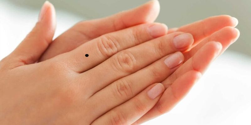 Nốt Ruồi Ở Tay Đánh Số Gì – Giải Mã Vận Mệnh Cùng Shbet 3 Chiến lược lô đề dựa trên nốt ruồi